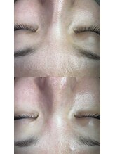 プラスボーテ 幡ヶ谷(plus beaute)/やる度に綺麗を実感！