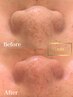 口コミ投稿でSパーツフェイスWAXプレゼント！