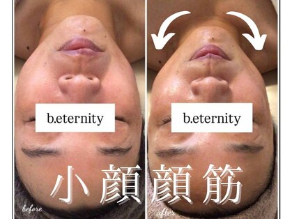 ビエタニティ(b.eternity)の写真