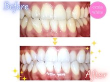 エクシアホワイト 倉吉店(ecxia white)