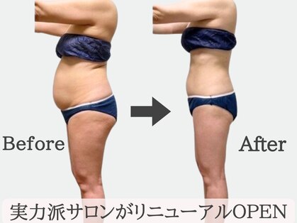 ロータスサリの写真