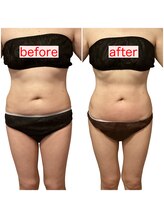 サロン ド ミコ(Salon de Mico)/50代　2ヶ月12回