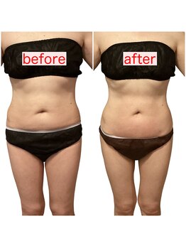 サロン ド ミコ(Salon de Mico)/50代 2ヶ月12回