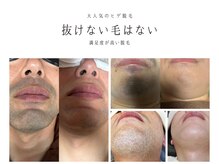 スリール(sourire)の雰囲気（【ヒゲ脱毛】毎朝の髭剃りを解消！肌荒れ改善）