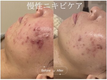 クレア(CLEA)/HAAB REPRO で叶える