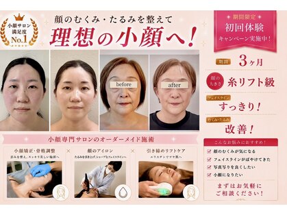 アガルコガオサロン(AGARU KOGAO SALON)の写真