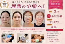アガルコガオサロン(AGARU KOGAO SALON)