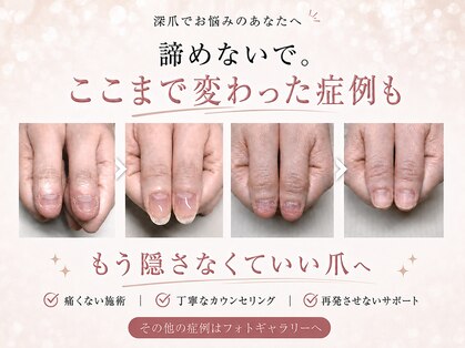 アウェイク(Awake)の写真
