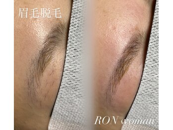 サロンロンウーマン(SALON RON woman)/眉毛脱毛