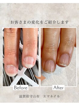 エマネイル(emma nail)/自爪育成やってます！