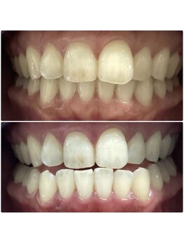 エスプライザ 鹿児島天文館店(ESPLIZA)/