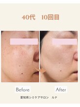 サロンルナ(Salon Luna)/40代　10回目