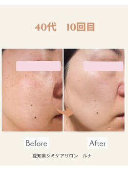 サロンルナ(Salon Luna)/40代　10回目