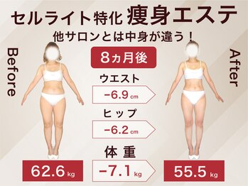 ラ パルレ 新宿新南口店/全身セルライトケア