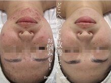 クレア(CLEA)/根本改善するならCLEAへ