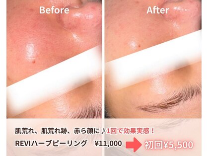 アクシア ビューティー サロン(AXSIA)の写真