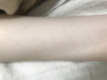 ナノハナ/鹿沼市本格全身脱毛ナノハナ