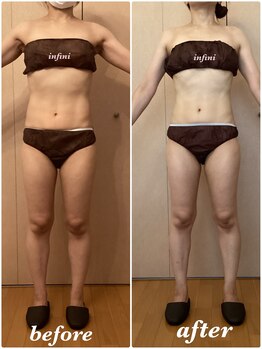 アンフィニ(infini)/短期集中コース7回目(3ヶ月)