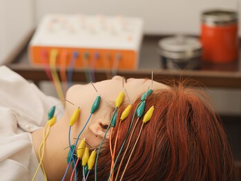 セットアップ鍼灸院(setup鍼灸院)/lift up美容鍼