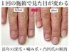 【女性/ハンド深爪矯正】長年の深爪から卒業！