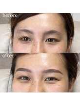 アイリー(IRIE)/HBL＋LASH lLIFT