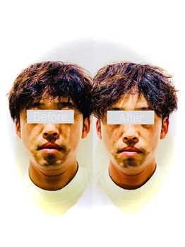 ワカヤマ 小顔(Wakayama)/☆Before・After☆