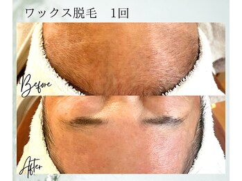 ポノ 茅ヶ崎(Pono.)/茅ケ崎/湘南/脱毛/毛穴/ハーブ