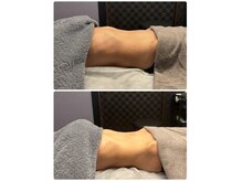 ロザリー(ROSALY)の雰囲気（骨盤から整えるHOT腸もみが新メニューとして登場。）