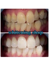 ホワイトニングショップ 倉敷店/