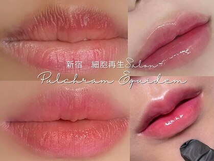 プルチャームエクイデム(Pulchram equidem)の写真