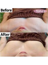 ナトゥーラ 心斎橋なんば本店(Natura)/左右差も改善し美バストへ★