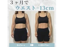 ビコツプロ(Bikotsu Pro)