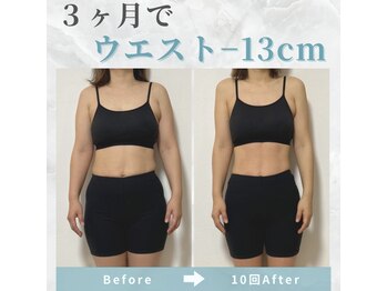 ビコツプロ(Bikotsu Pro)