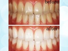 ティアラ 葛西店(TIARA)/