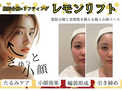 イーズスリミングプロ 横浜コレットマーレ店の写真