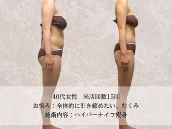 エクストリミティ 国立店(EXTREMITY)/お客様の変化