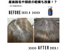 サンシー整体(SunCY整体)/４０代女性