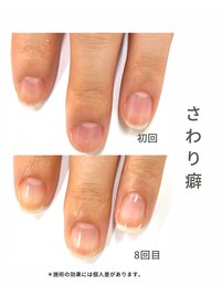 最強ネイルケア