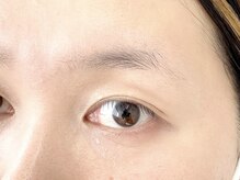 エルフ(elf)/薄眉改善(before) →