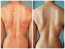 クランシュプール 恵比寿店/【ハノンケア/首肩コリ解消】