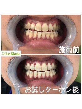 ルブラン 奈良店(Le Blanc)/フリーパスstart致しました！