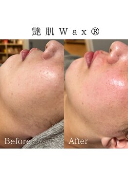 ビューティービューティー(BEAUTY BEAUTY)/