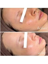 ナビレラ 自由が丘(Navillera)/眉毛＋全顔wax＋ブロウリフト