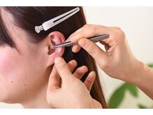 ナチュールフィット 宝塚店(Natur Fit)の雰囲気（耳ツボ施術）