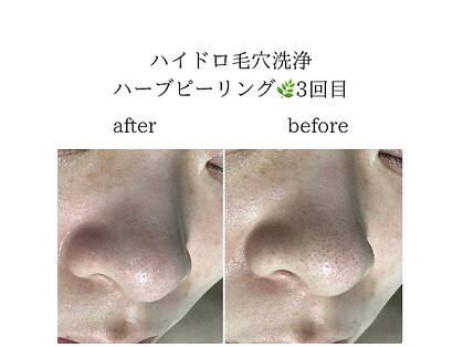 ロータス(LOTUS)の写真