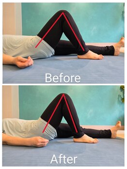 レニコ 三宮店(renico)/BEFORE/AFTER 5