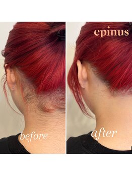 エピナス 大和店/うなじブラジリアンワックス