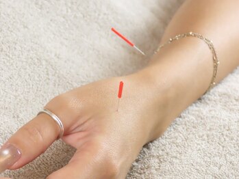 ビーネ 秋田(Beene)/痩身鍼灸施術
