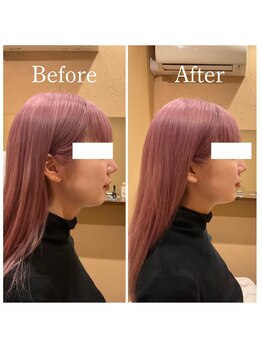 アキュレ(Acure)/