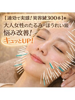 プレシャスワン 越谷店の写真/【速効で実感！美容鍼300本】☆大人女性のたるみ・ほうれい線のお悩み改善！キュッとリフトUP！